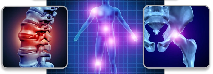 Medical graphic highlighting pain areas in the spine and hips.